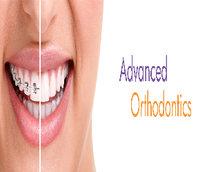 advanced-orthodontics