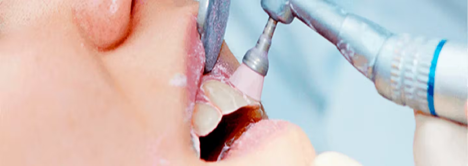 dental-article-banner