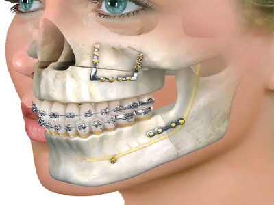 oral-maxillofacial.png