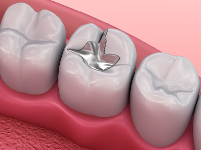 restorative-dentistry.png