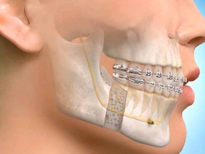 oral-maxillofacial-hospital