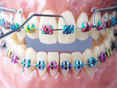 orthodontics-hospital