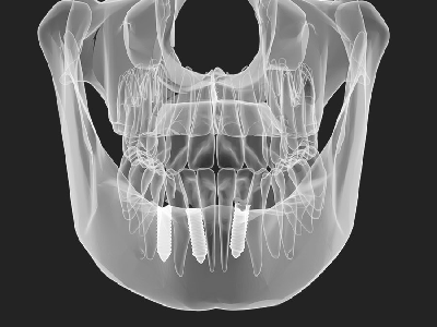 digital-x-ray-3d