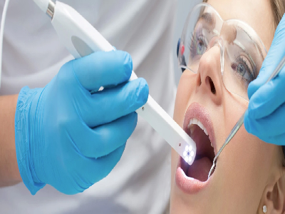 intraoral-camera